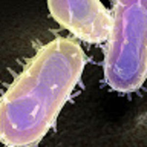 Meet your Posher, Bubonic